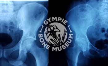 Museo de Huesos de Gympie
