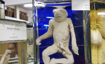 Museo de Patología de La Universidad de Buenos Aires