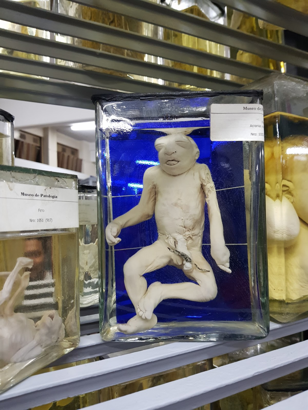 Museo de Patología de La Universidad de Buenos Aires