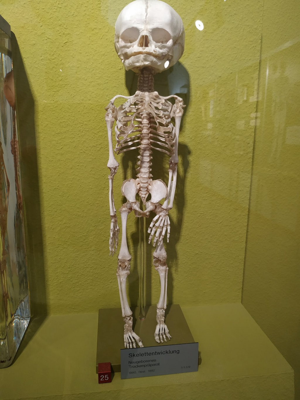 Museo Anatómico de la Universidad de Basilea